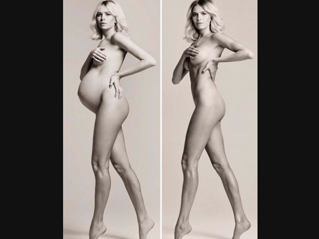 La top model rusa Elena Perminova (28) apareció en la edición de la revista Vogue de su país y abrió el debate.