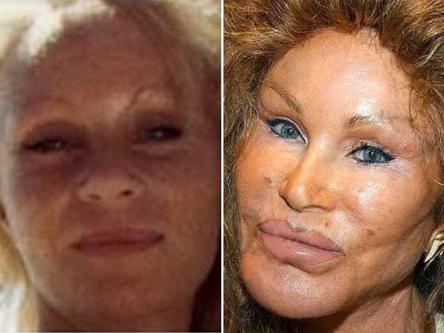 Jocelyn Wildenstein
