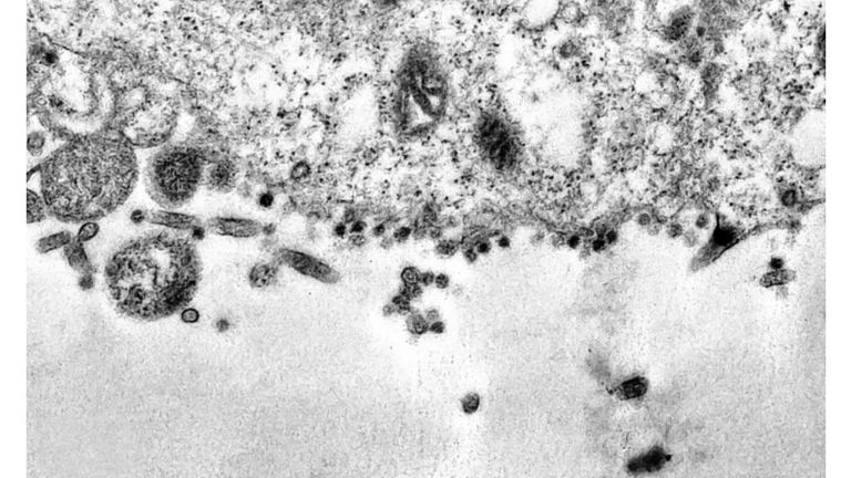 Científicos capturaron el momento exacto en el que el coronavirus infecta una célula
