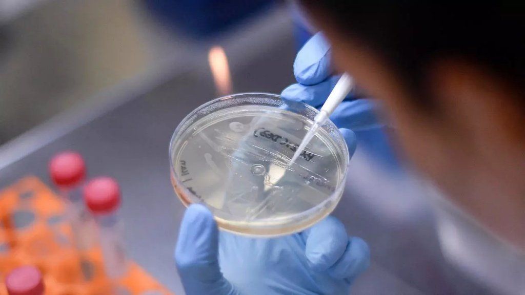 Con 87 nuevos casos, el total de infectados por coronavirus asciende a 1.715 con 60 muertos