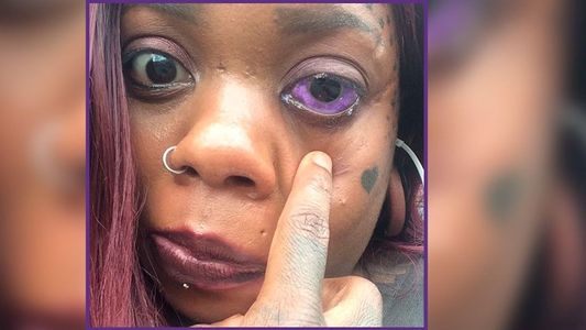 Una madre de cinco hijos se tatuó los globos oculares y ahora se está quedando ciega