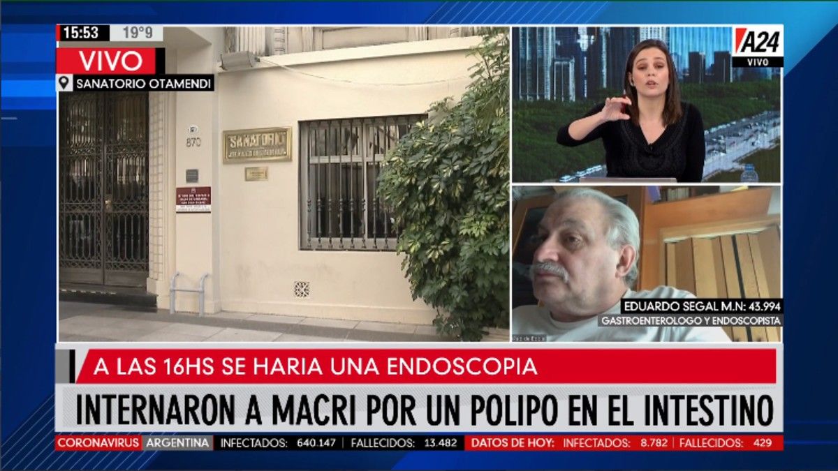 Qué es un pólipo y cómo es el procedimiento al que se sometió Mauricio Macri