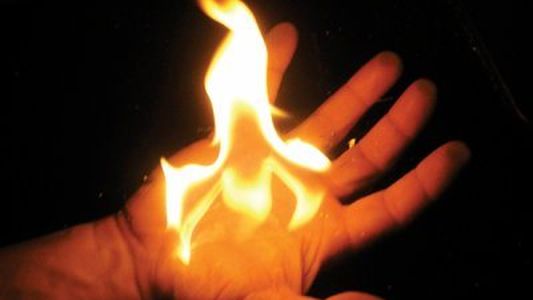 Un niño tiró alcohol a una salamandra, se quemó el 50% del cuerpo y su estado es delicado