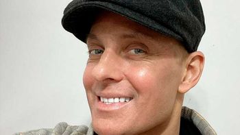 Lío Pecoraro le dedicó un emotivo posteo a su hermana a cinco meses de su trasplante