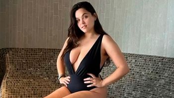 Preocupación por modelo de OnlyFans que quedó en silla de ruedas por usar el celular