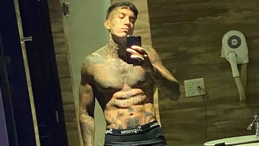 Eloy Rivera recibió el alta y lanzó fuertes declaraciones tras ser acusado de intentar asesinar a su ex: Ella está re loca