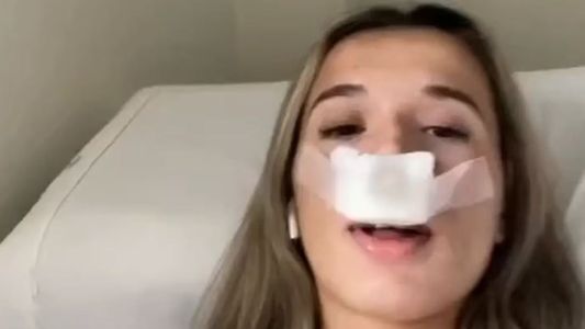 Se hizo la cirugía de nariz para evitar que sus hijos hereden la suya