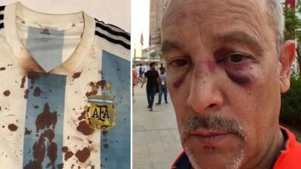 Mundial Qatar 2022 | Un argentino fue brutalmente por hinchas mexicanos (Foto: ADN Noticias).