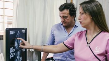 Mamotest: cómo es la startup argentina que usa IA para prevenir el cáncer de mama