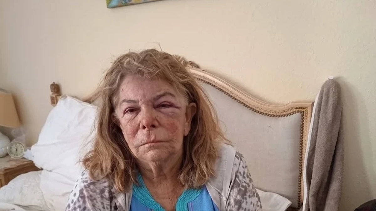Violenta entradera a unajubilada. (Foto: gentileza diario La Capital de Mar del Plata)