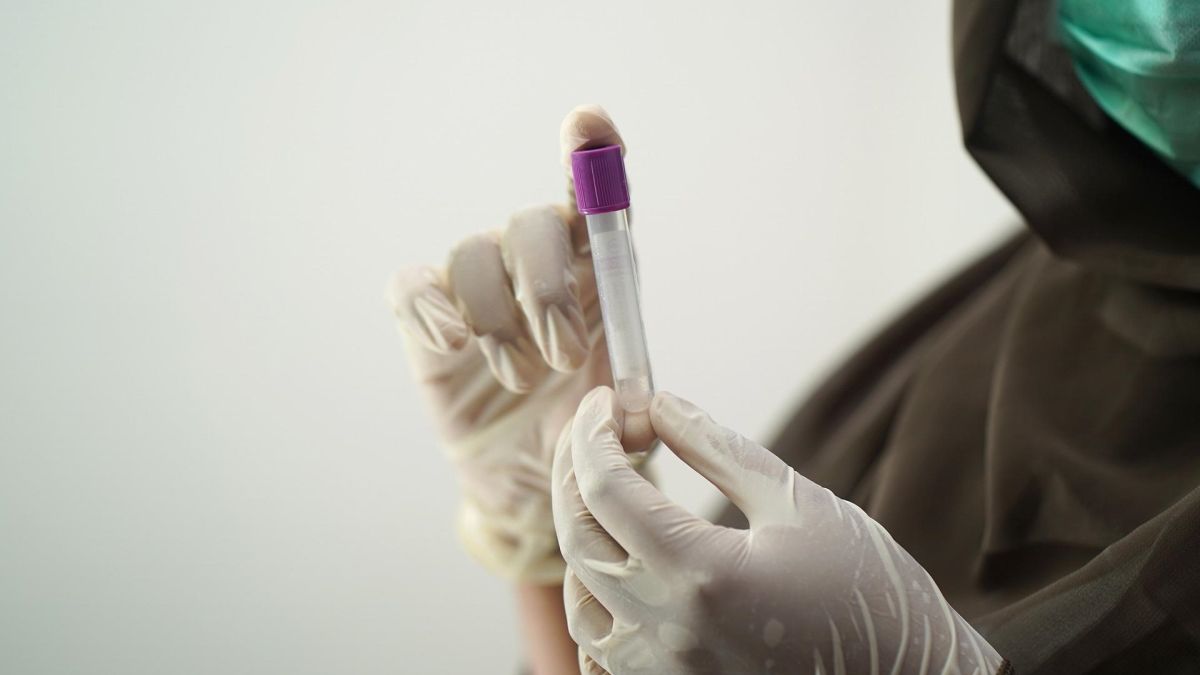 Detectan el primer caso de coinfección por viruela del mono