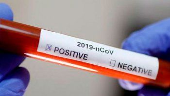 Los contagios siguen en aumento: en 24 horas se registraron 2.146 nuevos casos y el total trepó a 44.931