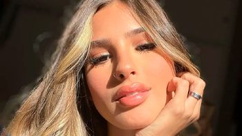 Julieta Poggio generó preocupación con unas alarmantes fotos