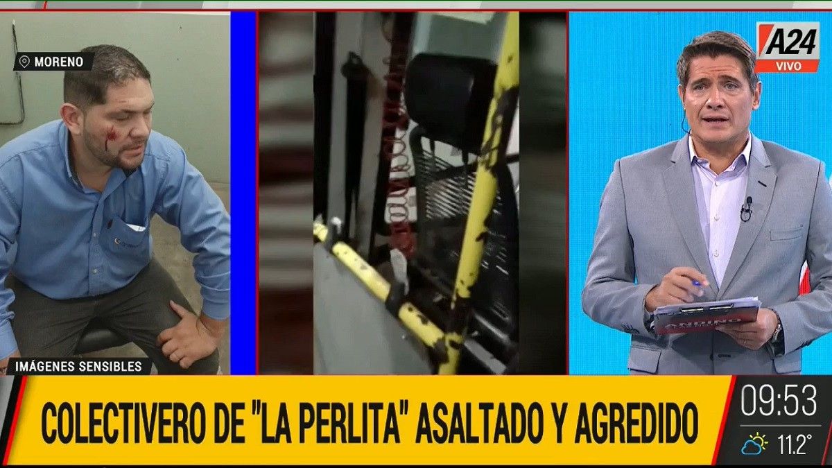 Nuevo ataque. Así quedó el colectivero agredido en Moreno. Foto: captura de Tv.&nbsp;