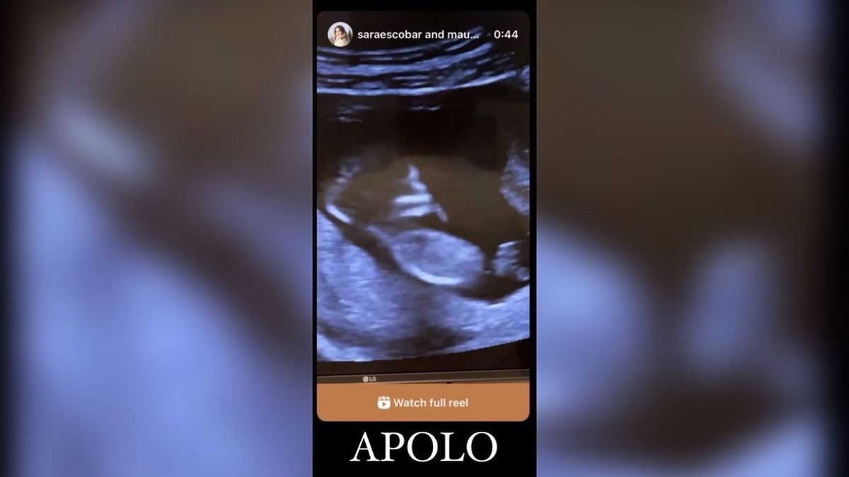La primera ecograf&iacute;a de Apolo, el hijo que esperan Mau Montaner y Sara Escobar.&nbsp;
