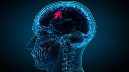 Tumor cerebral: cuáles son los síntomas y causas de la enfermedad que terminó con la vida de Gerardo Rozín