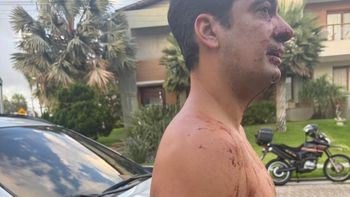 Quién es el ex Boca acusado de morderle la nariz a un hombre durante una pelea