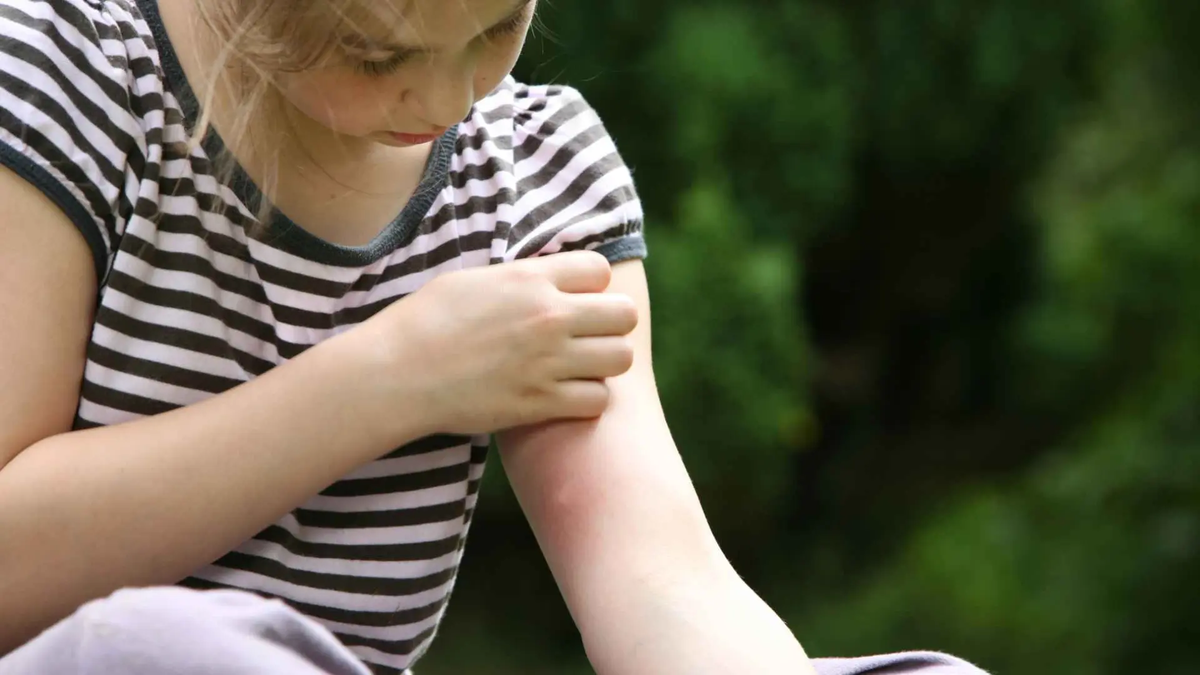 Las plantas aromáticas ayudan a enmascarar el dióxido de carbono y otros olores corporales que atraen a los mosquitos