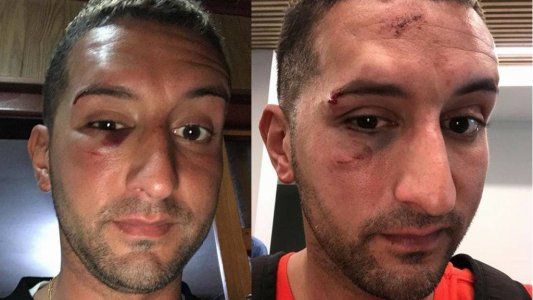 Habló el turista atacado por piqueteros en Misiones