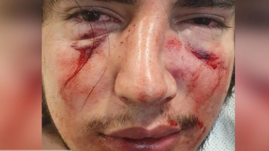 Denuncian que dos rugbiers golpearon brutalmente a un joven en un country de Córdoba