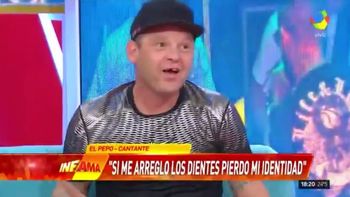 El Pepo contó la anécdota de la ausencia de su diente