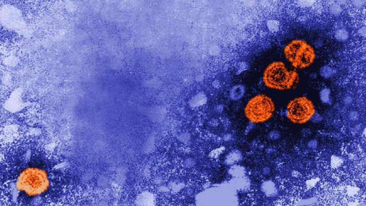 Imagen de microscopía electrónica de transmisión coloreada digitalmente revela la presencia de viriones de la hepatitis B (de color naranja). (Foto: CDC)