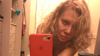 La selfie al desnudo de Cecilia Roth para mostrar su moretón en la pierna