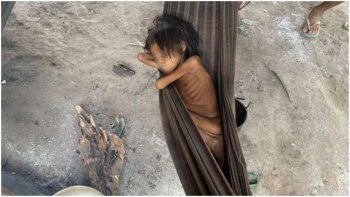 La foto que nadie quiere ver: una nena de 8 años que pesa sólo 12 kilos