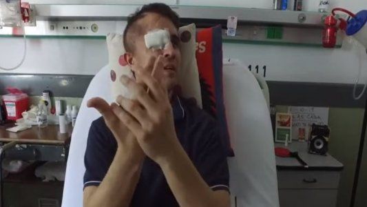 Entrevista exclusiva con el agente  atropellado por Veppo: Tengo trauma de salir a la calle, estamos muy descuidados