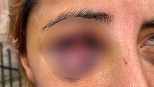 La golpeó hasta dejarla casi muerta, la escondió debajo de la cama y su hija de 12 años la salvó