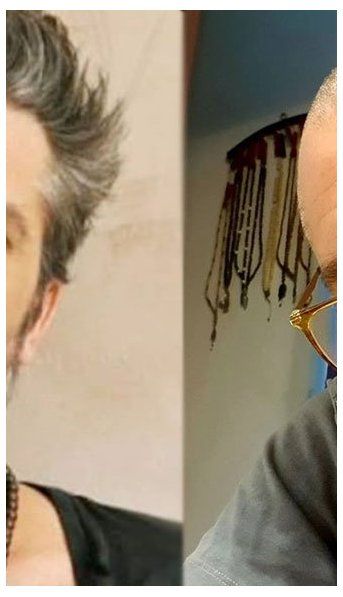 Maxi Ghione contó que se realizará a un operación que podría cambiarle la vida