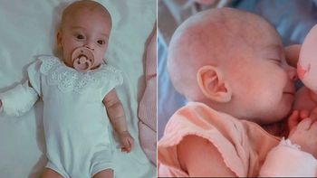 Quién es Luna: la beba de 2 meses que necesita que se apruebe un medicamento para vivir