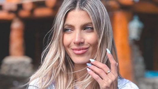 La angustia de Cande Ruggeri tras una ola de críticas a su aspecto físico: Es horrible