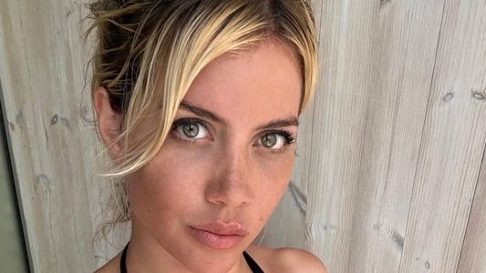 Se supo cuánto costó la operación que se habría realizado Wanda Nara