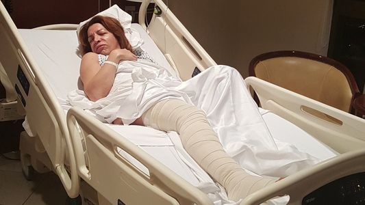 Lizy Tagliani se operó las várices y subió todas las fotos de la internación