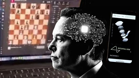 Elon Musk presentó el increíble avance de un joven parapléjico al que le implantaron un chip en el cerebro