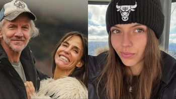 El duro accidente que sufrió la hija de Facundo Arana y María Susini en medio de la separación