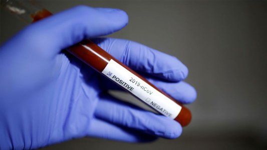 Nuevo reporte de COVID-19: se sumaron 1.208 casos y 21 muertos en las últimas 24 horas