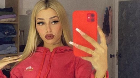 Tamara Báez mostró cómo quedó su nueva boca