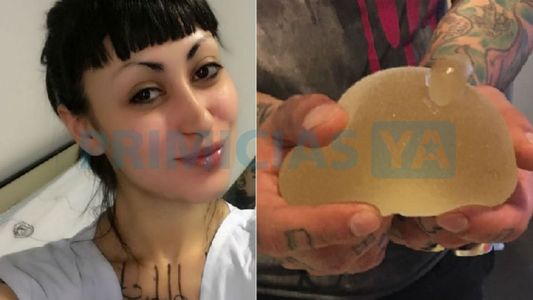 Tamara Gala operada de urgencia: Ahora estoy con mucho dolor pero sana y recuperándome
