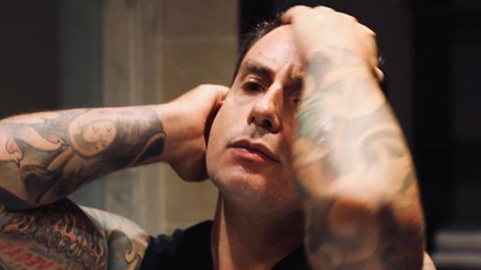 Fede Bal mostró las marcas en su brazo tras el accidente y operación en Brasil