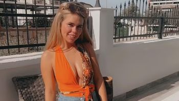 Aprovechó una oferta para hacer un tratamiento dental y terminó con una sonrisa de caballo