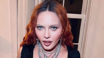 Dieron de alta a Madonna y ya se recupera en su casa de la grave infección bacteriana