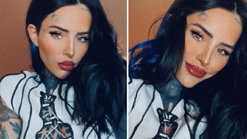 Candelaria Tinelli pasó por el quirófano y contó qué se hizo