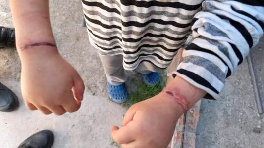 Maltrato infantil: rescataron a un nene que había sido atado con alambres por su madre en Moreno