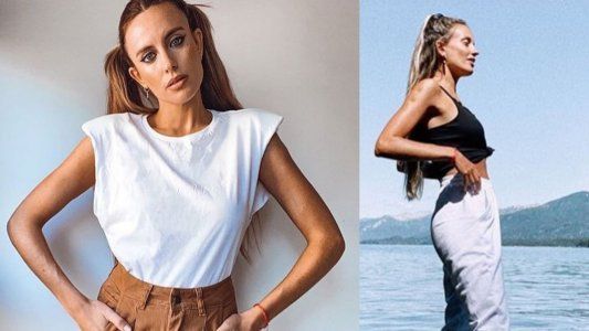 Melina Lezcano confesó qué cirugía se arrepintió de haberse hecho