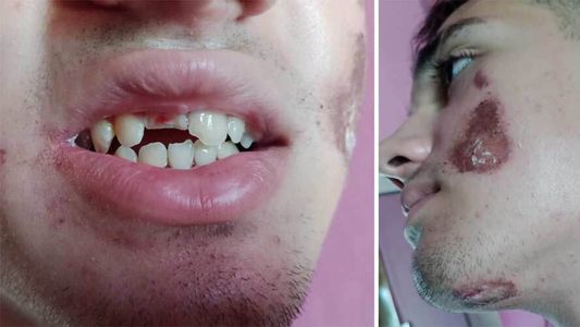 Un chico quedó inconsciente y desfigurado tras ser agredido por otros diez jóvenes a la salida de un boliche