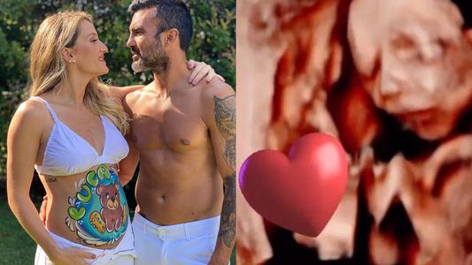 Mica Viciconte compartió una ecografía con la carita de su bebé