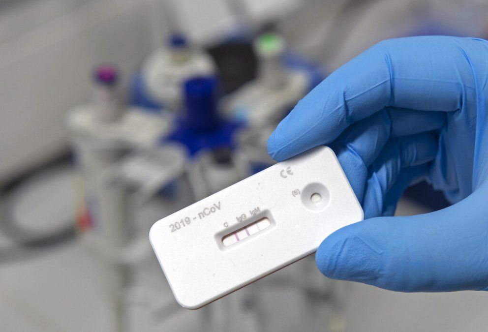 Las clínicas privadas podrán realizar el test de coronavirus sin necesidad de validarlo en el Malbrán