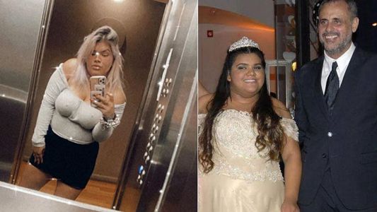 More Rial contó cuánto llegó a pesar antes de someterse a la cirugía de bypass gástrico